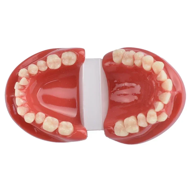 Dental Teeth Malocclusion Model Teaching Model Demonstration Tool Dentist Students Practice Teaching Training Dentistry Tools
Dental Teeth Malocclusion Model Teaching Model Demonstration Tool Dentist Students Practice Teaching Training Dentistry Tools