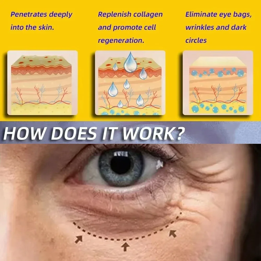 Retinol Remove Eye Bags Dark Circles Anti Aging Lifting Firming Whitening Moisturizing Brighten Skin Care Anti-Wrinkle Eye Cream
Retinol Remove Eye Bags Dark Circles Anti Aging Lifting Firming Whitening Moisturizing Brighten Skin Care Anti-Wrinkle Eye Cream