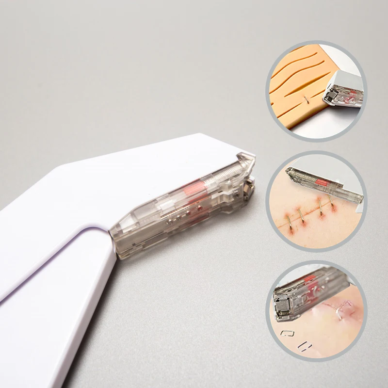 China Factory Disposable S/kin Stapler Sterile Titanium Staple S/urgical Sk/in Wound Closure Device for M/edical Use
China Factory Disposable S/kin Stapler Sterile Titanium Staple S/urgical Sk/in Wound Closure Device for M/edical Use