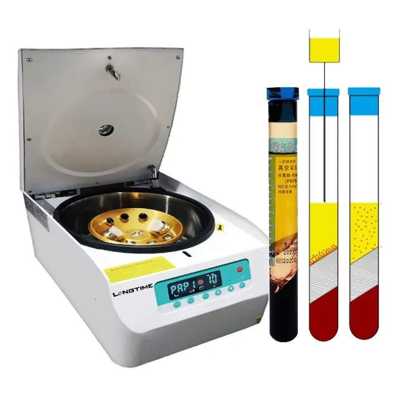 Low-Speed Benchtop Centrifuge for Plasma Separation in Laboratory Use
Low-Speed Benchtop Centrifuge for Plasma Separation in Laboratory Use