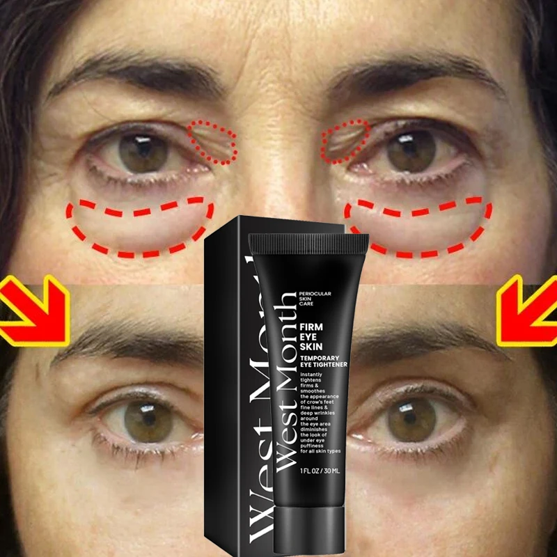 Eye Bags Removal Cream Anti Puffiness Dark Circles Tightens Eyes Lifting Firming Fade Fine Lines Brighten Lively Eye Skin Care
Eye Bags Removal Cream Anti Puffiness Dark Circles Tightens Eyes Lifting Firming Fade Fine Lines Brighten Lively Eye Skin Care