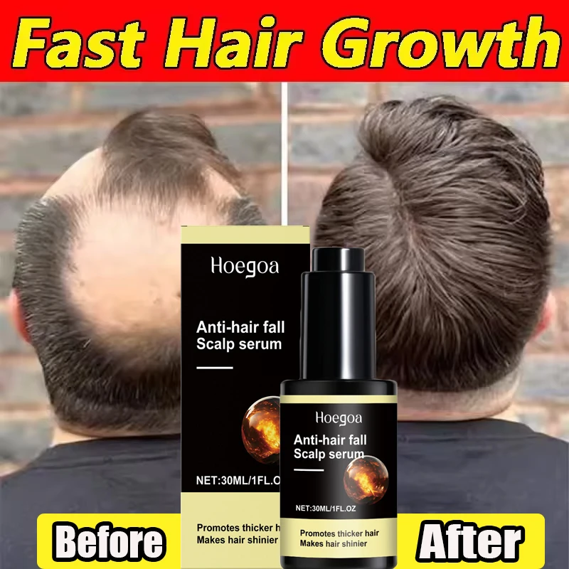 Сыворотка для роста волос с имбирем, корни, против выпадения волос, сыворотка для восстановления роста волос, поврежденная кожа головы, восстановление, питательные средства по уходу для женщин и мужчин
Сыворотка для роста волос с имбирем, корни, против выпадения волос, сыворотка для восстановления роста волос, поврежденная кожа головы, восстановление, питательные средства по уходу для женщин и мужчин