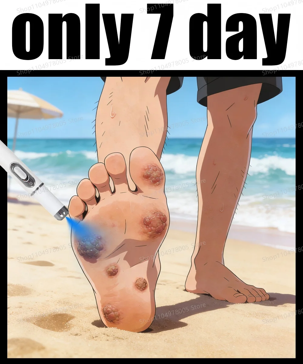 Wart Removal Pen - Safe and Effective, Warts Fall Off Automatically
Wart Removal Pen - Safe and Effective, Warts Fall Off Automatically