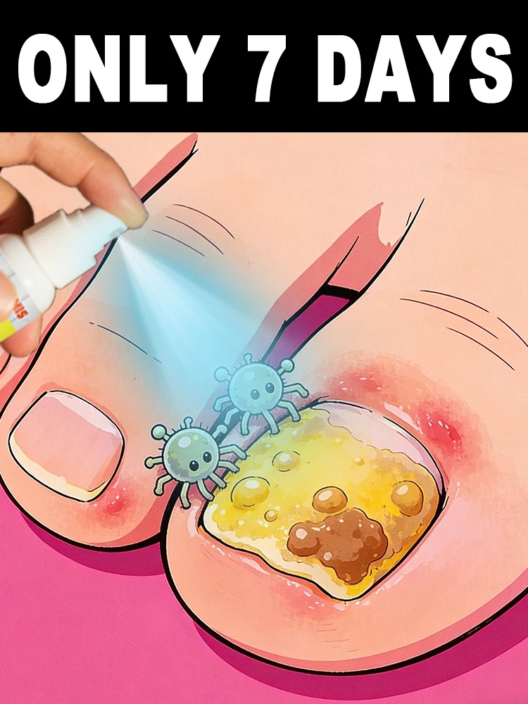 One spray provides protection against recurrence, ᵉᵃˢⁱˡʸ ˡᵉᵃᵈⁱⁿᵍ ᵗᵒ ʰᵉᵃˡᵗʰʸ ⁿᵃⁱˡˢ‧
One spray provides protection against recurrence, ᵉᵃˢⁱˡʸ ˡᵉᵃᵈⁱⁿᵍ ᵗᵒ ʰᵉᵃˡᵗʰʸ ⁿᵃⁱˡˢ‧