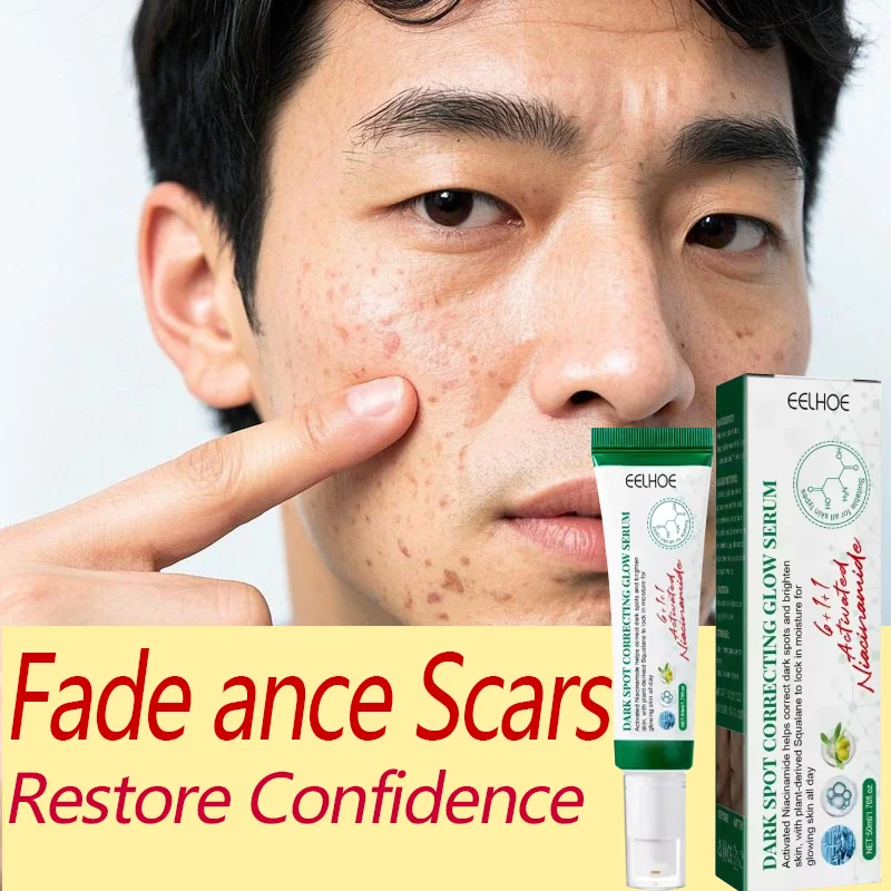 Восстановление ямы от прыщей для мужчин и женщин Уменьшает темные пятна Осветляет цвет лица Увлажняет и питает кожу Уменьшает производство меланина
Восстановление ямы от прыщей для мужчин и женщин Уменьшает темные пятна Осветляет цвет лица Увлажняет и питает кожу Уменьшает производство меланина