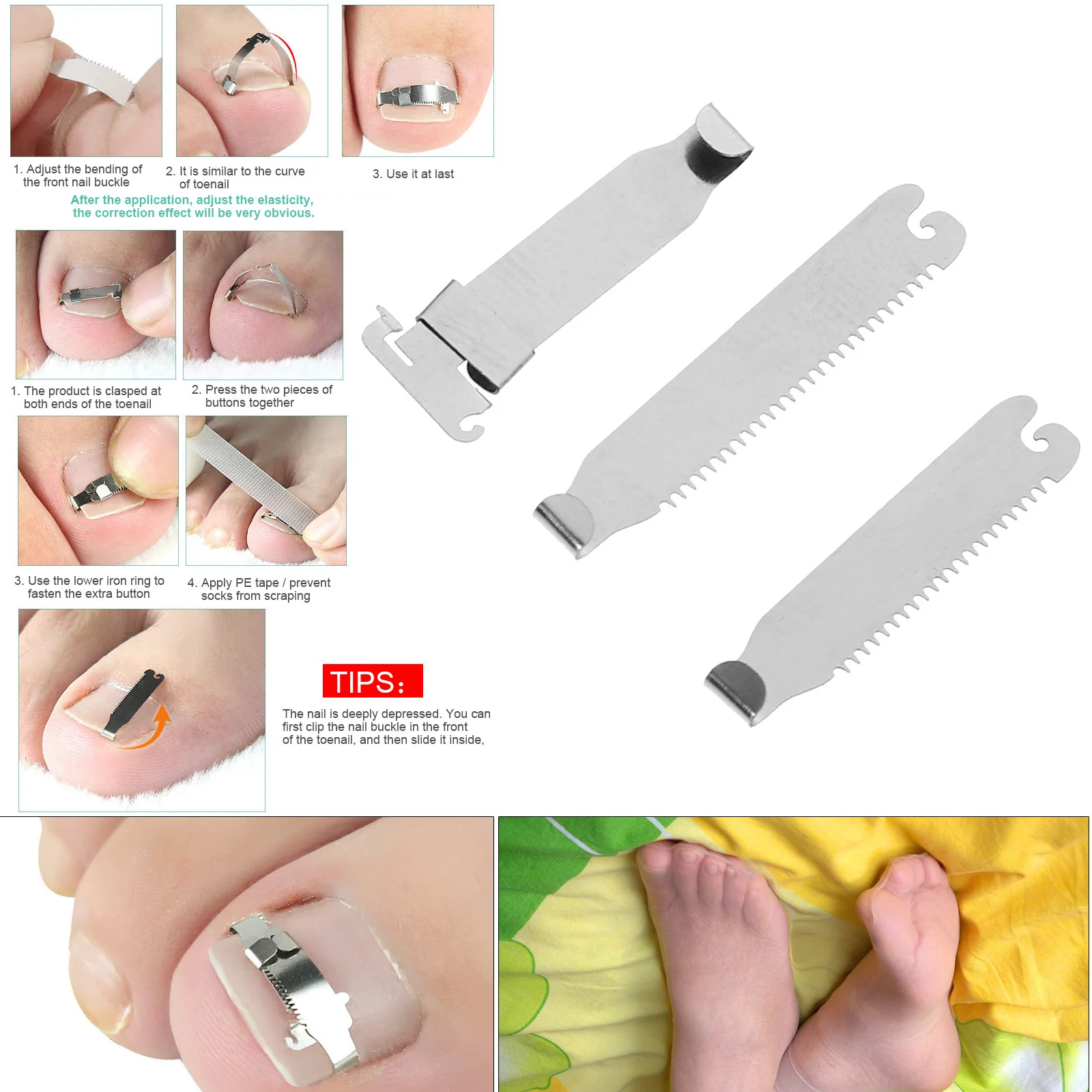 1pc Toenails Correction Buckles Stainless Steel Size 38 Ingrown Toenail Corrector Tool Pedicure Repair Braces Clip Foot Care
1pc Toenails Correction Buckles Stainless Steel Size 38 Ingrown Toenail Corrector Tool Pedicure Repair Braces Clip Foot Care
