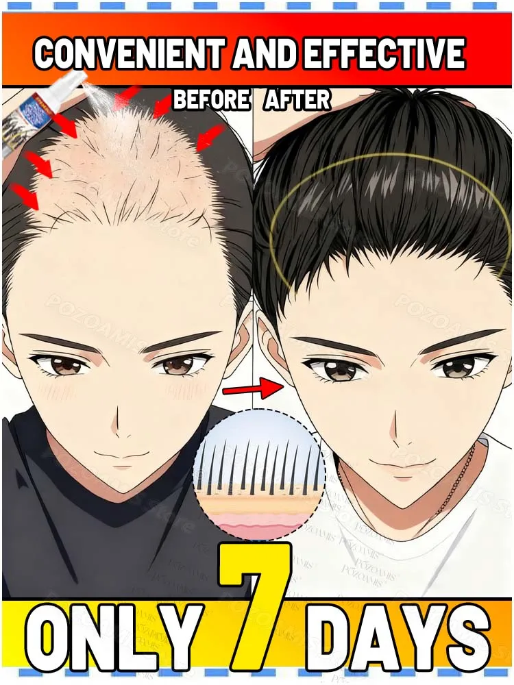 Крошечный пуз, пророщенный верхом головы, как новая трава весной.
Крошечный пуз, пророщенный верхом головы, как новая трава весной.