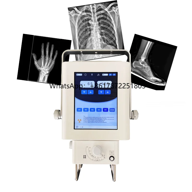Portable X Ray Machine Medical Digital X Ray Screening System 5.3kW DR X-ray System Price for Human Hospital Use With FPD
Portable X Ray Machine Medical Digital X Ray Screening System 5.3kW DR X-ray System Price for Human Hospital Use With FPD