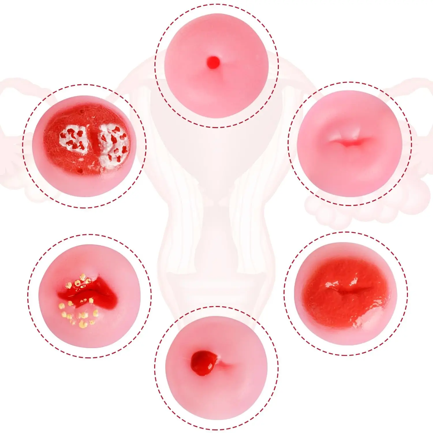 Ultrassist Cervix Pathology Model with 6 Cervical Replicas for OB/GYN Training & Patient Education Gynecological Teaching Tool
Ultrassist Cervix Pathology Model with 6 Cervical Replicas for OB/GYN Training & Patient Education Gynecological Teaching Tool