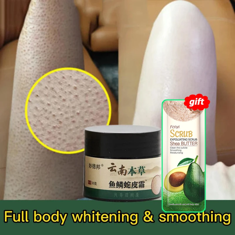 Chicken Skin Repair Cream Curing Keratosis Follicle Pilaris Remove Thick Pores Body Scrub Dark Spot Moisturize Smooth Skin Care
Chicken Skin Repair Cream Curing Keratosis Follicle Pilaris Remove Thick Pores Body Scrub Dark Spot Moisturize Smooth Skin Care