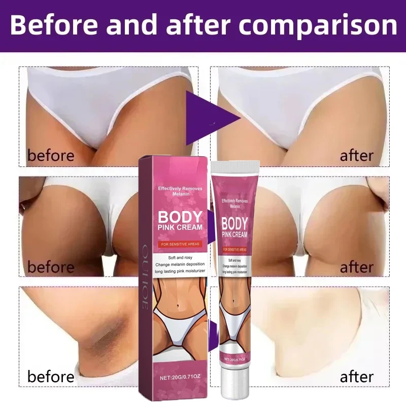 Bleaching Cream Inner Thighs Hips Intimate Areas Knuckle Bleaching Serum Moisturizing Hydrating Skin Cleansing Glow Brightening
Bleaching Cream Inner Thighs Hips Intimate Areas Knuckle Bleaching Serum Moisturizing Hydrating Skin Cleansing Glow Brightening
