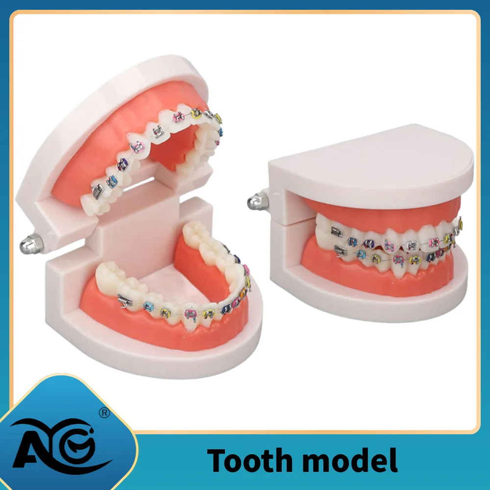 Модель зубов AG Dental для ортодонтии с цветными брекетами, профессиональный демонстрационный учебный инструмент для стоматологии
Модель зубов AG Dental для ортодонтии с цветными брекетами, профессиональный демонстрационный учебный инструмент для стоматологии