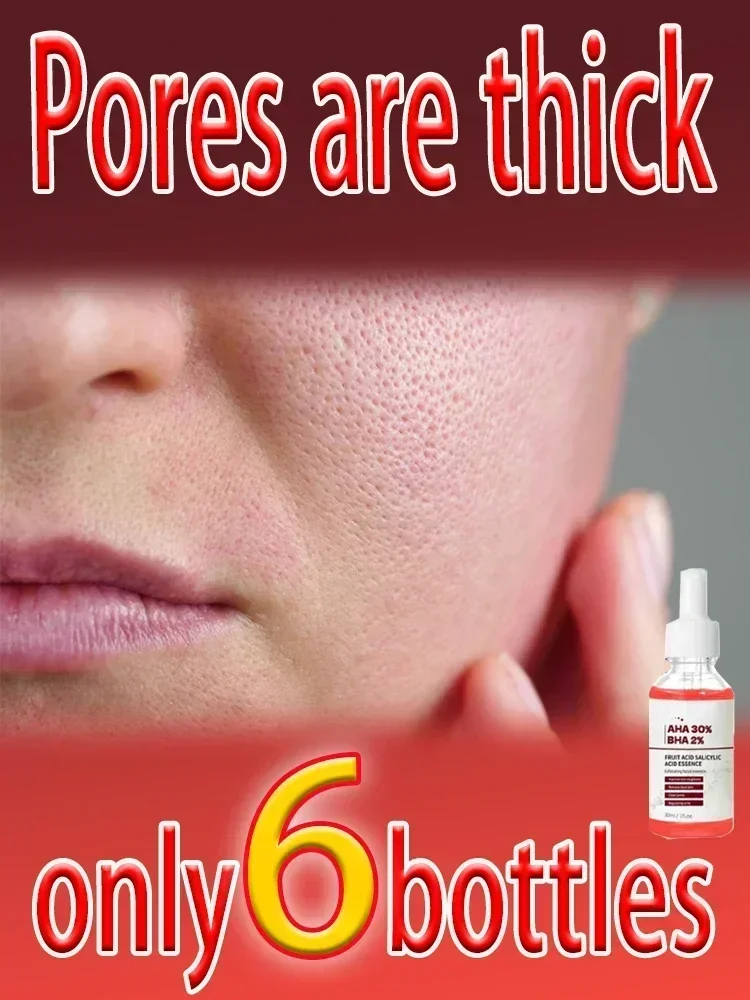 Pore Shrinking Serum Repairs Large Pores Salicylic Acid Face Serum Anti-wrinkle Facial Serum Oil Control Whitening Skin Care
Pore Shrinking Serum Repairs Large Pores Salicylic Acid Face Serum Anti-wrinkle Facial Serum Oil Control Whitening Skin Care