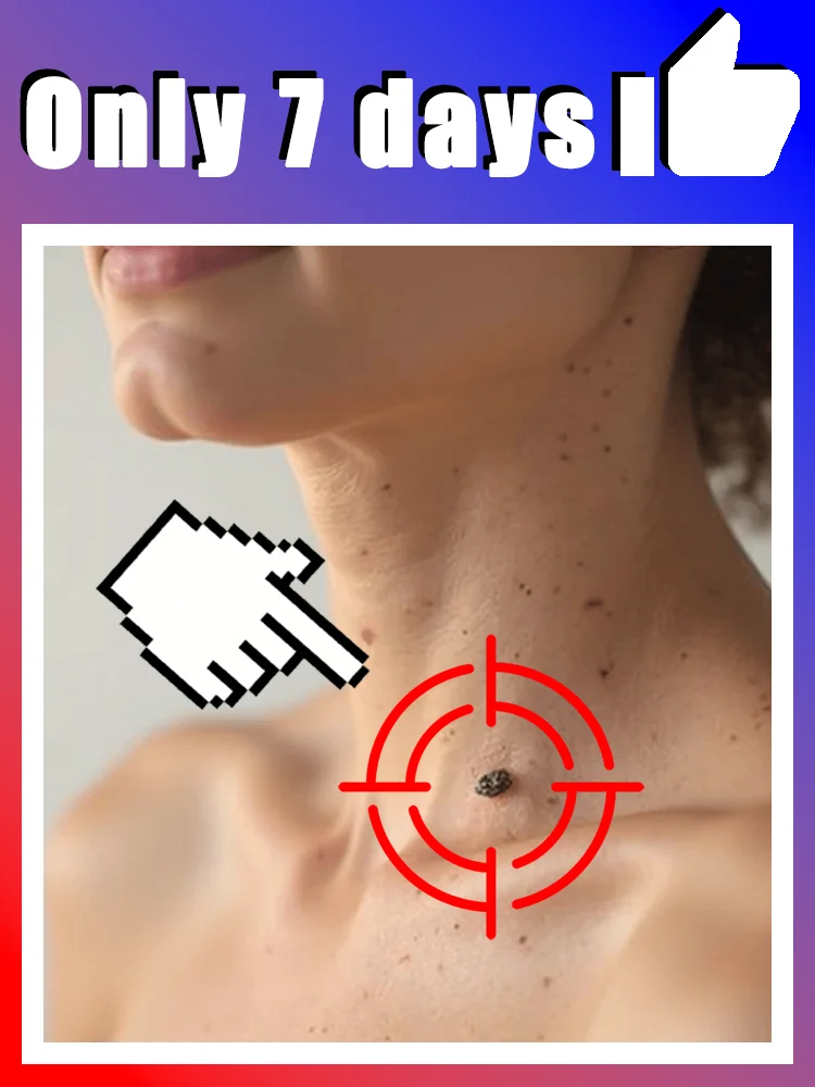 Make your life less troublesome for warts Body tools,free shipping,Hotsale for warts
Make your life less troublesome for warts Body tools,free shipping,Hotsale for warts