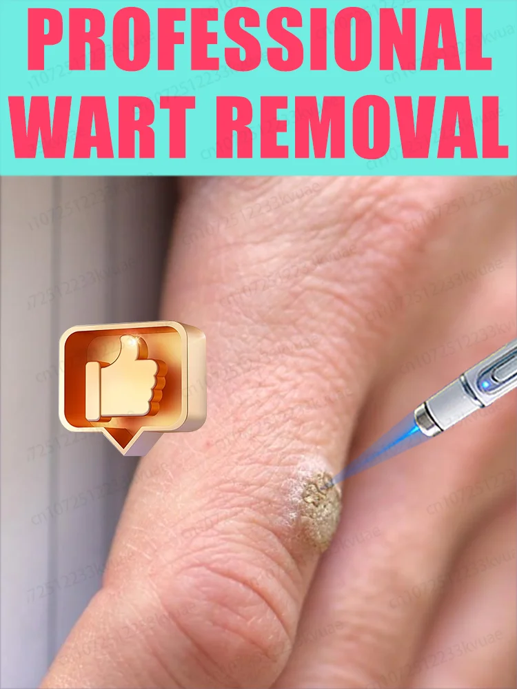 Бог удаления бородавок, zobacz результаты в семь дней
Бог удаления бородавок, zobacz результаты в семь дней