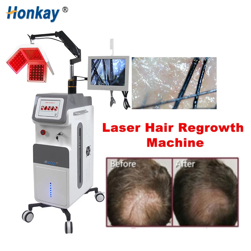 Portable 650nm Diode Laser Hair Growth Machine Regrowth Anti-Hair Loss LED Light Therapy Pro activated Hair Follicle Fast Growth
Portable 650nm Diode Laser Hair Growth Machine Regrowth Anti-Hair Loss LED Light Therapy Pro activated Hair Follicle Fast Growth