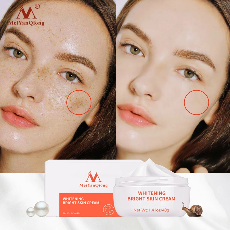 40g Whitening Freckle Cream Face Moisturizing Remove Dark Spots Melanin Melasma Remove Natural Dressing Skin Repair Anti-Aging
40g Whitening Freckle Cream Face Moisturizing Remove Dark Spots Melanin Melasma Remove Natural Dressing Skin Repair Anti-Aging