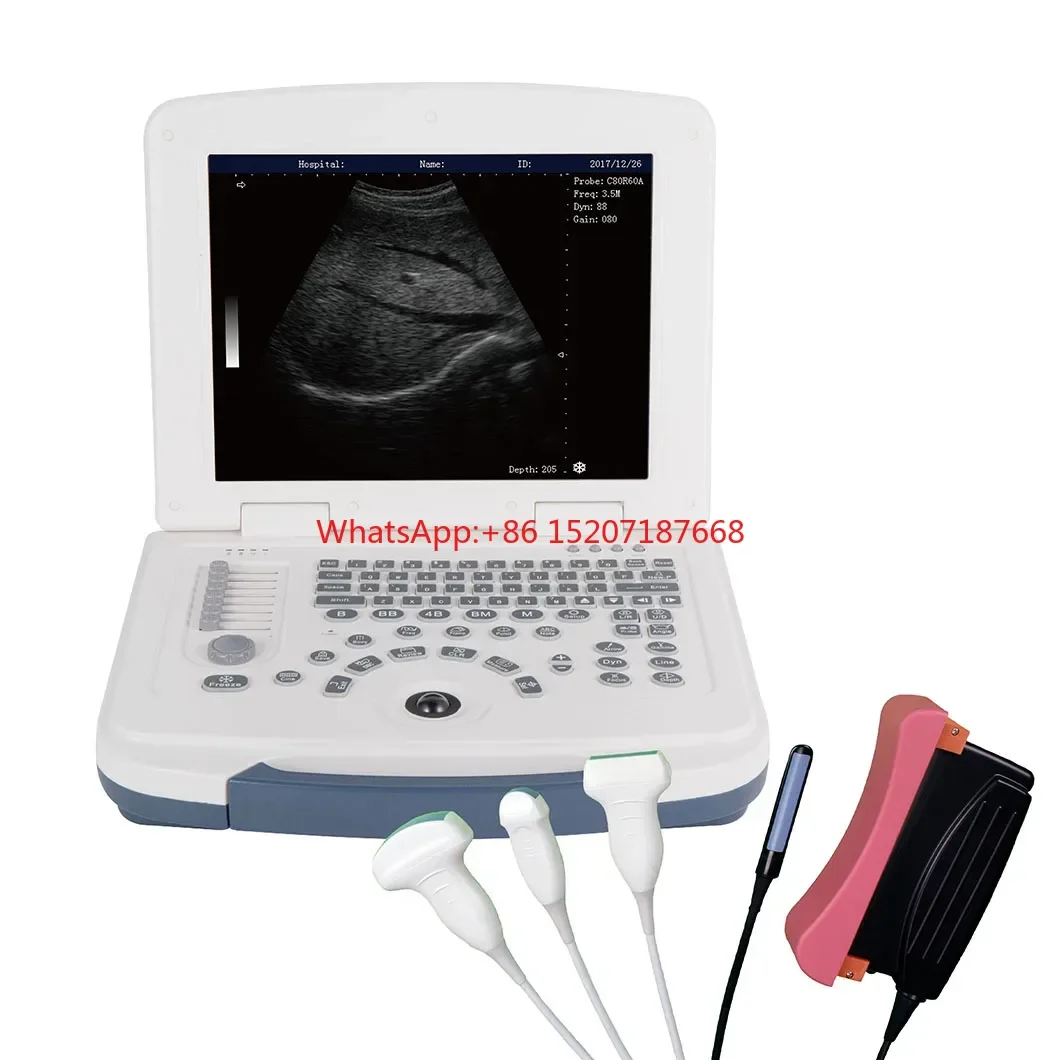 Cheap Price Animal Vet Portable Ultrasound Machine Veterinary Scanner Equipment
Cheap Price Animal Vet Portable Ultrasound Machine Veterinary Scanner Equipment