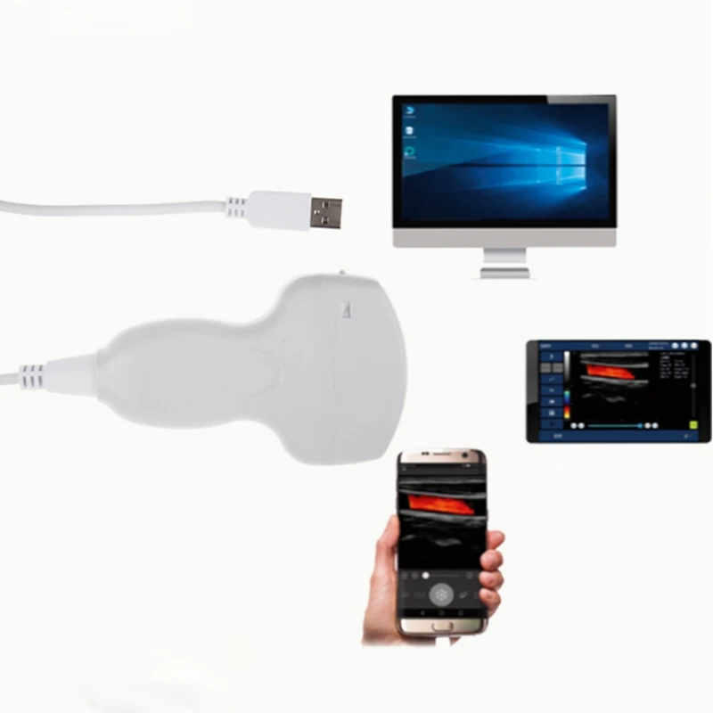 Самый дешевый портативный цветной допплер, ультразвуковой аппарат/CE iPhone /Android, беспроводные ультразвуковые аппараты, линейный зонд
Самый дешевый портативный цветной допплер, ультразвуковой аппарат/CE iPhone /Android, беспроводные ультразвуковые аппараты, линейный зонд