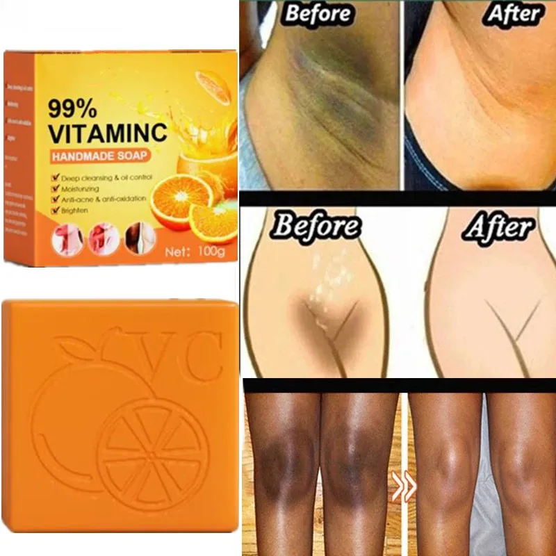 99% VC Soap Handmade Whitening Soap Skin Lightening Soap Hand made Soap Glutathione Whitening Soap Skin Bleaching Cleaning
99% VC Soap Handmade Whitening Soap Skin Lightening Soap Hand made Soap Glutathione Whitening Soap Skin Bleaching Cleaning