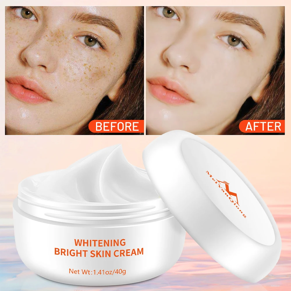 Whitening Face Cream Moisturizing Freckle Cream Remove Melasma Inhibit Dark Spots Pigment Melanin Anti Wrinkle Beauty Health
Whitening Face Cream Moisturizing Freckle Cream Remove Melasma Inhibit Dark Spots Pigment Melanin Anti Wrinkle Beauty Health