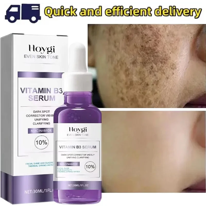 Powerful Dark Spots Remover Whitening Serum Face Freckle Melanin Correcting Anti Pigmentation Brighten Skin Beauty Care Products
Powerful Dark Spots Remover Whitening Serum Face Freckle Melanin Correcting Anti Pigmentation Brighten Skin Beauty Care Products