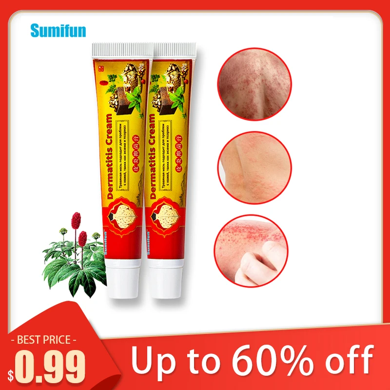 Just $0.99 1Pcs Psoriasis Cream Dermatitis Eczema Ointment Treatment Scaly Plaques Psoriasis Tinea Pedis Relieve Itch Skin Care
Just $0.99 1Pcs Psoriasis Cream Dermatitis Eczema Ointment Treatment Scaly Plaques Psoriasis Tinea Pedis Relieve Itch Skin Care