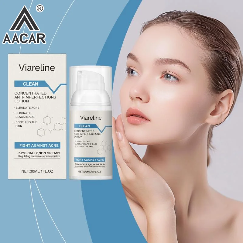 Soothing Acne Removing Repairing Lotion, Oil Control, Refreshing, Non greasy and Moisturizing
Soothing Acne Removing Repairing Lotion, Oil Control, Refreshing, Non greasy and Moisturizing