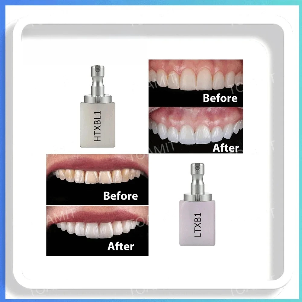 3Boxes Dental Ceramic Blocks, High Translucent HT/LT Zirconia Disc for CAD/CAM, Anterior Crowns Veneers, Sirona CEREC Compatible
3Boxes Dental Ceramic Blocks, High Translucent HT/LT Zirconia Disc for CAD/CAM, Anterior Crowns Veneers, Sirona CEREC Compatible