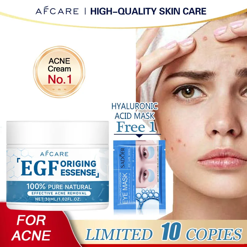 EGF Face Cream Acne Treatment Lightening Acne Remover Pimple Repair Skin Whitening Korean Skin Care Products Beauty Health
EGF Face Cream Acne Treatment Lightening Acne Remover Pimple Repair Skin Whitening Korean Skin Care Products Beauty Health