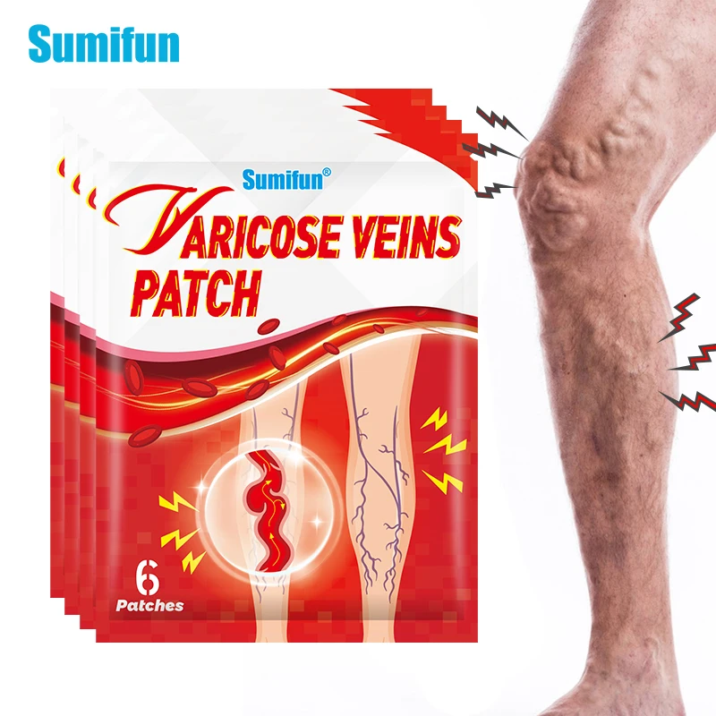 6/12/24Pcs Varicose Vein Patch Phlebitis Vasculitis Massage Sticker Varicosity Angiitis Spider Leg Medical Plaster Beauty Health
6/12/24Pcs Varicose Vein Patch Phlebitis Vasculitis Massage Sticker Varicosity Angiitis Spider Leg Medical Plaster Beauty Health