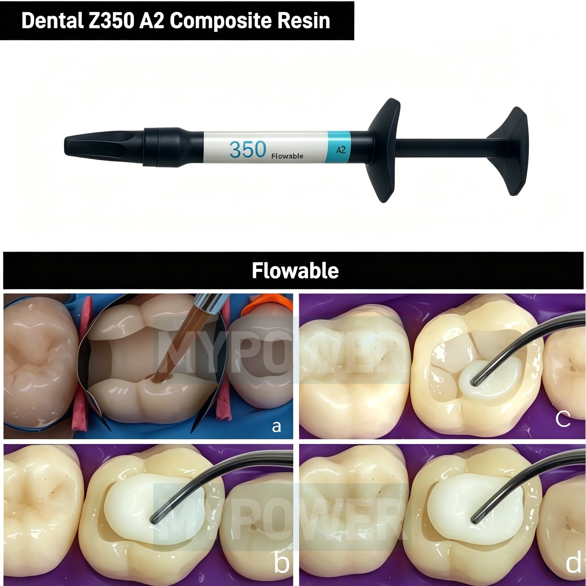 Z350 A2 Shade Light‑Cure Dental Composite Resin 2g Flowable Restorative Material for Teeth Filling Veneer & Whitening Restorat
Z350 A2 Shade Light‑Cure Dental Composite Resin 2g Flowable Restorative Material for Teeth Filling Veneer & Whitening Restorat