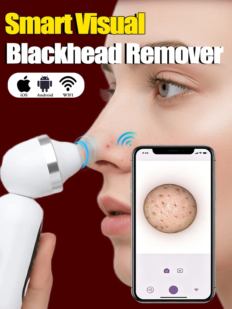 blackheads Pore Vacuum Cleaning Blackhead Removal Tools.
blackheads Pore Vacuum Cleaning Blackhead Removal Tools.
