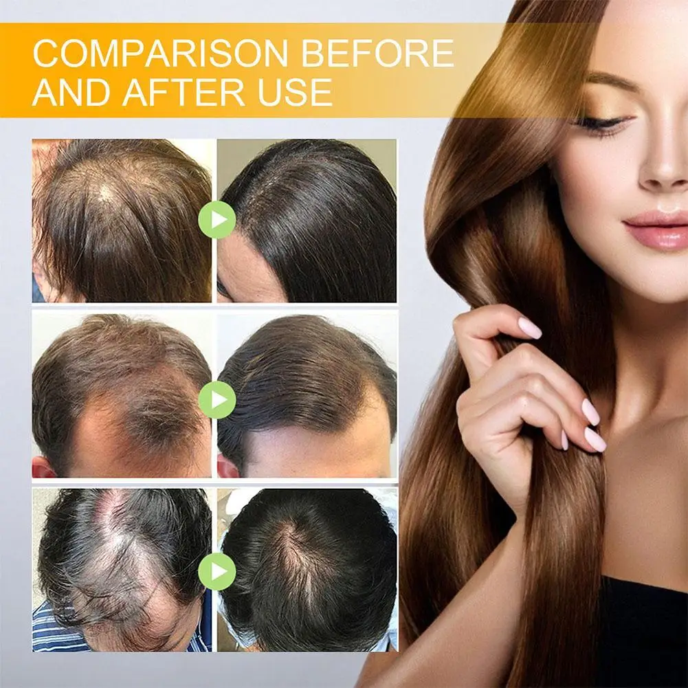 EELHOE Biotin Hair Spray For Man Women 30ml Repair Damage Restore Oil Scalp Repair Serum Spray Thicken Hair Health Care New
EELHOE Biotin Hair Spray For Man Women 30ml Repair Damage Restore Oil Scalp Repair Serum Spray Thicken Hair Health Care New
