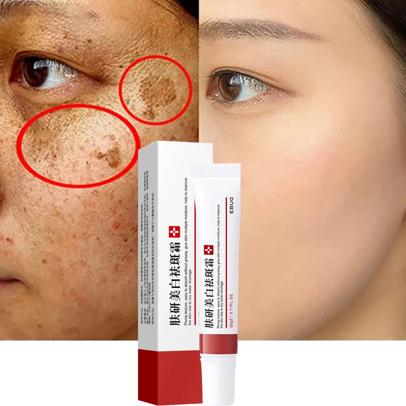 Effective Whitening Freckle Cream Remove Dark Melasma Lighten Acne Scars Melanin Anti-Aging Brighten Skin Care Face Cream 20g
Effective Whitening Freckle Cream Remove Dark Melasma Lighten Acne Scars Melanin Anti-Aging Brighten Skin Care Face Cream 20g