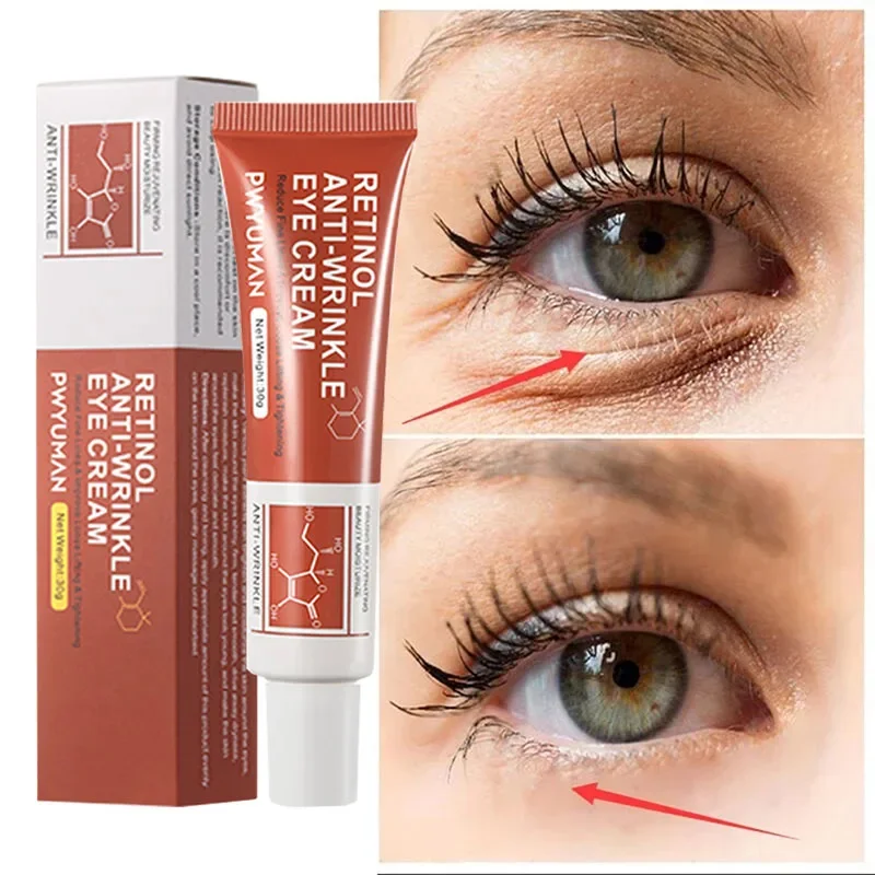 Instant Eye Bag Removal Cream Retinol Anti-Wrinkle Fade Fine Lines Firming Skin Anti Dark Circle Puffiness Brighten Eye Care
Instant Eye Bag Removal Cream Retinol Anti-Wrinkle Fade Fine Lines Firming Skin Anti Dark Circle Puffiness Brighten Eye Care