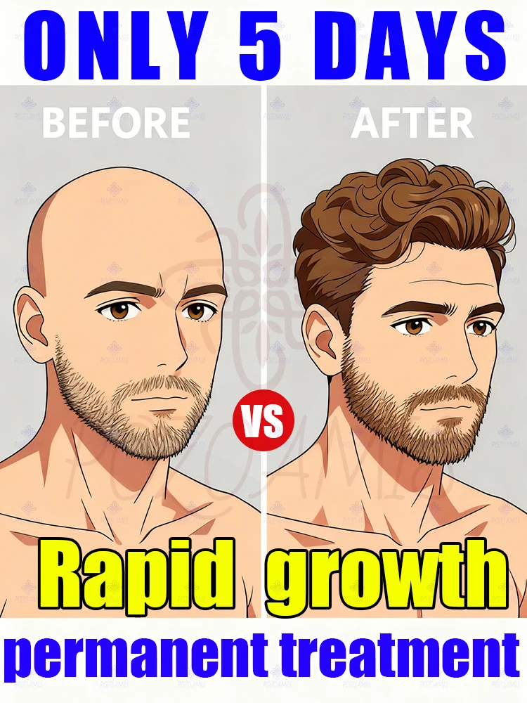 Созванное обнаженной кожей головы Используйте этот соунер для улучшения ситуации.
Созванное обнаженной кожей головы Используйте этот соунер для улучшения ситуации.