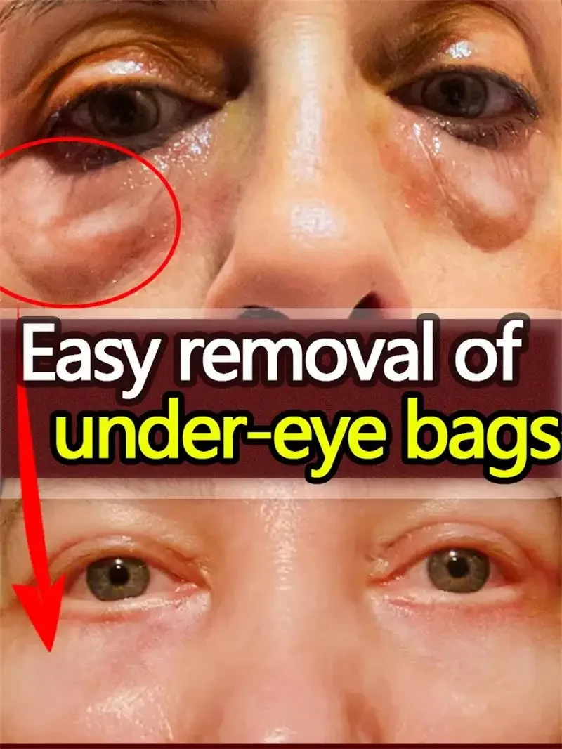Collagen Eye Mask Anti-Wrinkle Eye Patches Fade Fine Line Remove Dark Circle Bag Anti-Puffiness Moisturizing Brighten Skin Care
Collagen Eye Mask Anti-Wrinkle Eye Patches Fade Fine Line Remove Dark Circle Bag Anti-Puffiness Moisturizing Brighten Skin Care