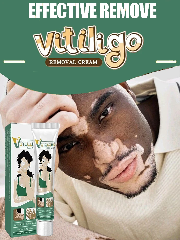 Remove White Spot Cream for Vitiligo White Spots Leukoplakia Pigmentation Melanin Promoting Vitiligo Cream Skin Care
Remove White Spot Cream for Vitiligo White Spots Leukoplakia Pigmentation Melanin Promoting Vitiligo Cream Skin Care