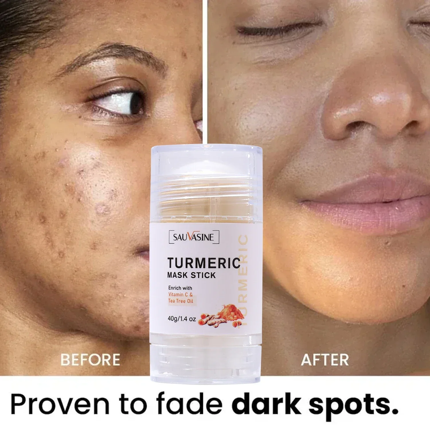 Turmeric Mask Stick (vc & Tea Tree Oil) Facial Deep Cleansing Applicator Acne Shrinkage Oil Control Blackheads Moisturising
Turmeric Mask Stick (vc & Tea Tree Oil) Facial Deep Cleansing Applicator Acne Shrinkage Oil Control Blackheads Moisturising