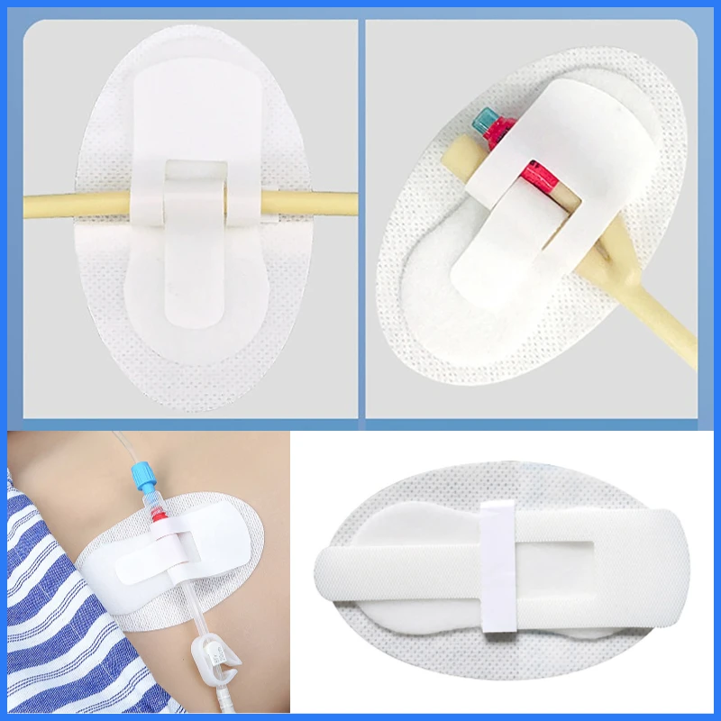 1Pcs Catheter Fixation Stickers Catheter Tube Strap Urinary Legband Urine Fixing Device Anchor G Stabilization
1Pcs Catheter Fixation Stickers Catheter Tube Strap Urinary Legband Urine Fixing Device Anchor G Stabilization