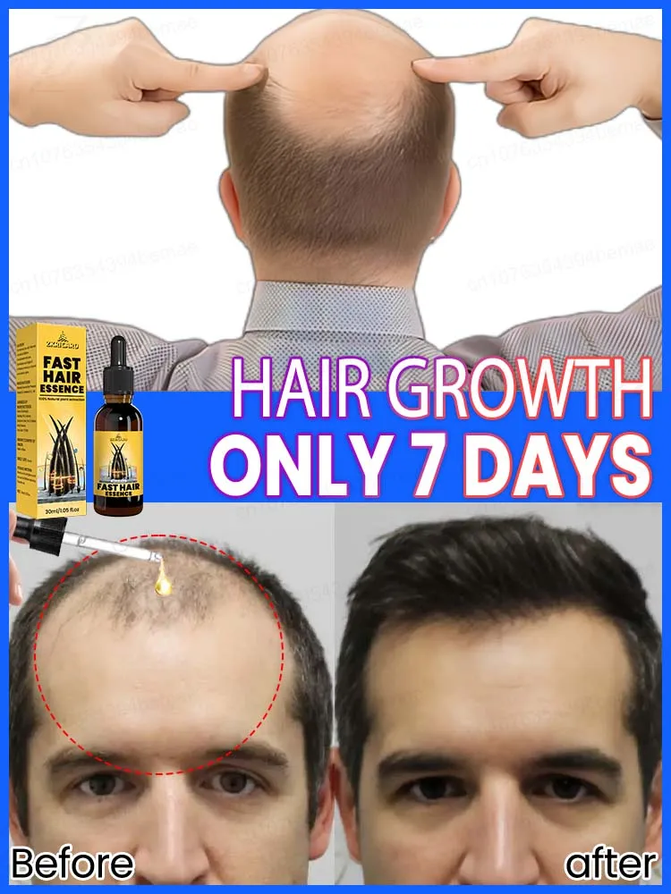 Hair care essential oil nourishes hair, makes hair shiny, and repairs hair damage caused by perming and dyeing
Hair care essential oil nourishes hair, makes hair shiny, and repairs hair damage caused by perming and dyeing