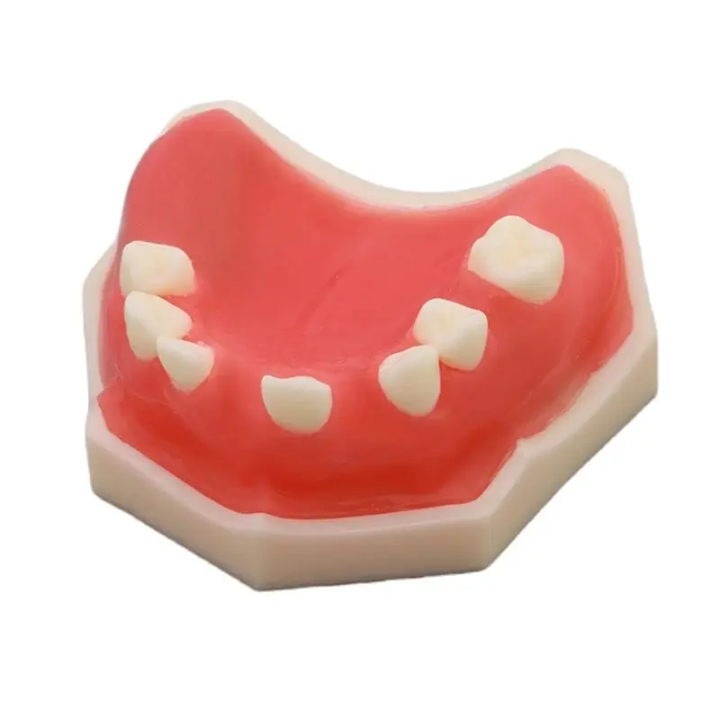 Dental M2009 Implant Practice Model Dental Dentist Training Standard Model for Student Study
Dental M2009 Implant Practice Model Dental Dentist Training Standard Model for Student Study