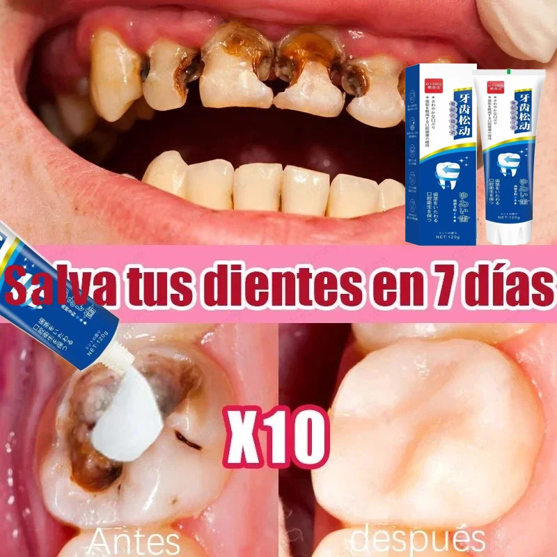 Quick Repair Cavities Caries Probiotic Toothpaste Clean Whiten Remove Yellow Plaque Protect Gum Reduce Tooth Stains Fresh Breath
Quick Repair Cavities Caries Probiotic Toothpaste Clean Whiten Remove Yellow Plaque Protect Gum Reduce Tooth Stains Fresh Breath