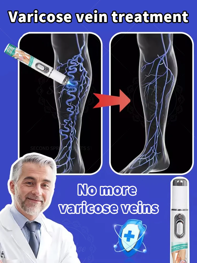 Improve blood circulation and reduce varicose veins Laser pointer for varicose veins
Improve blood circulation and reduce varicose veins Laser pointer for varicose veins