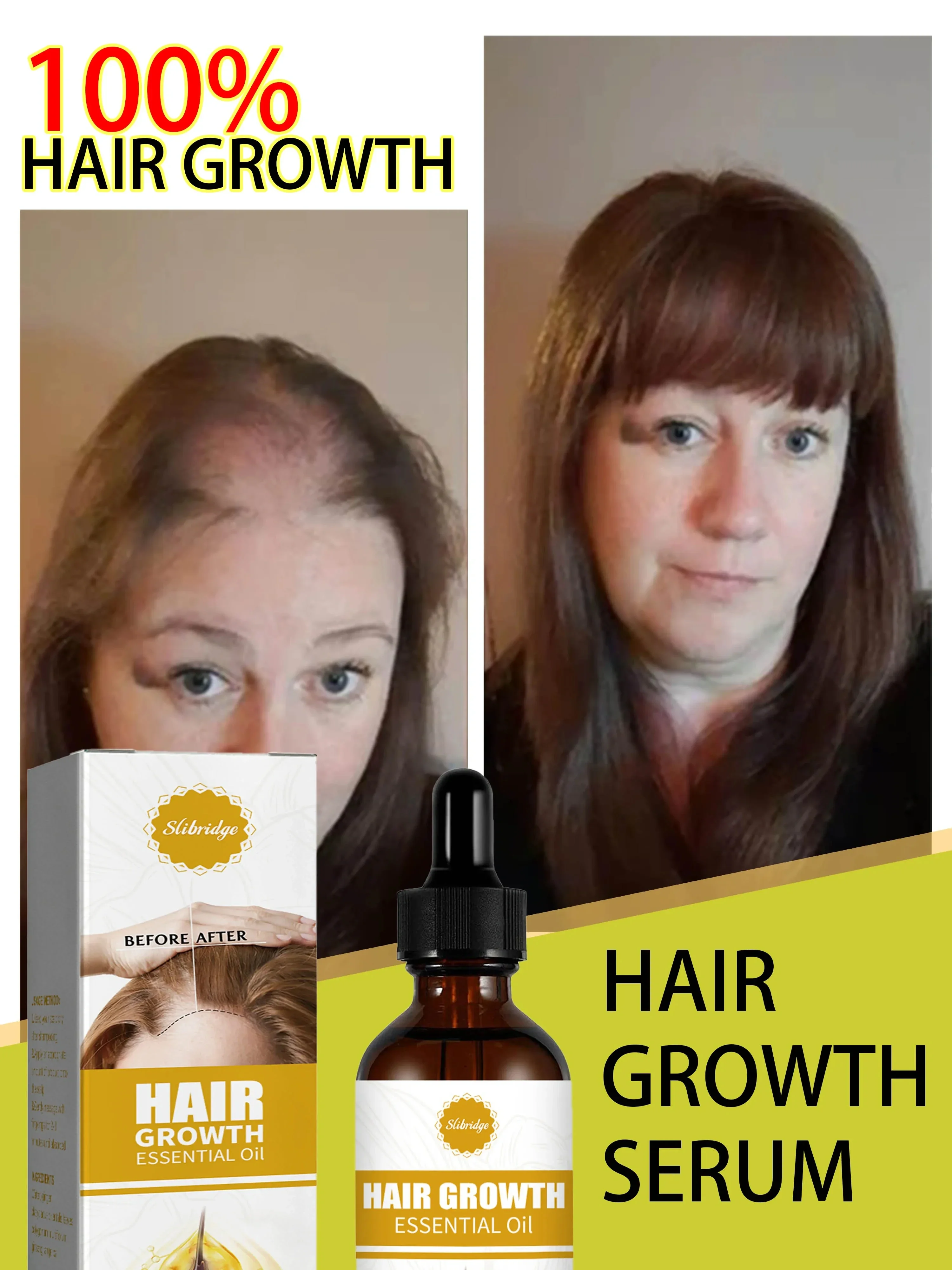 O óleo de crescimento capilar faz o cabelo crescer rapidamente, repara eficazmente a calvície e a queda de cabelo hereditária
O óleo de crescimento capilar faz o cabelo crescer rapidamente, repara eficazmente a calvície e a queda de cabelo hereditária