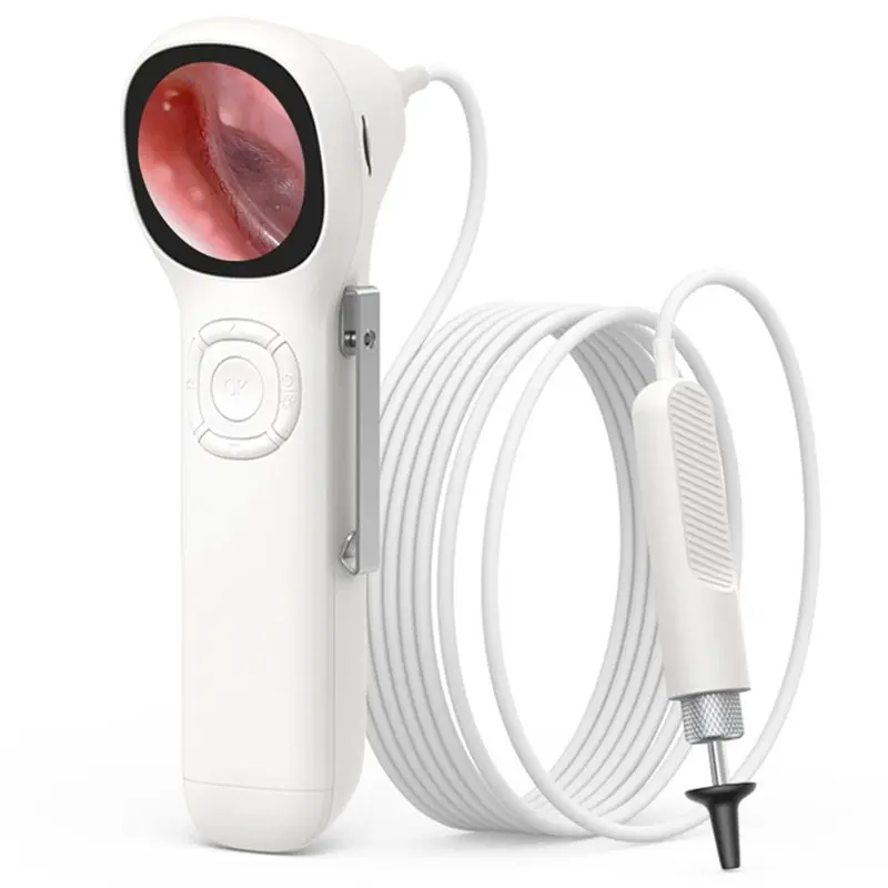 ABGH-Ear Wax Removal Tool Camera Ear Wax 1.45 Inch IPS 720P HD Smart Visual Ear Camera
ABGH-Ear Wax Removal Tool Camera Ear Wax 1.45 Inch IPS 720P HD Smart Visual Ear Camera