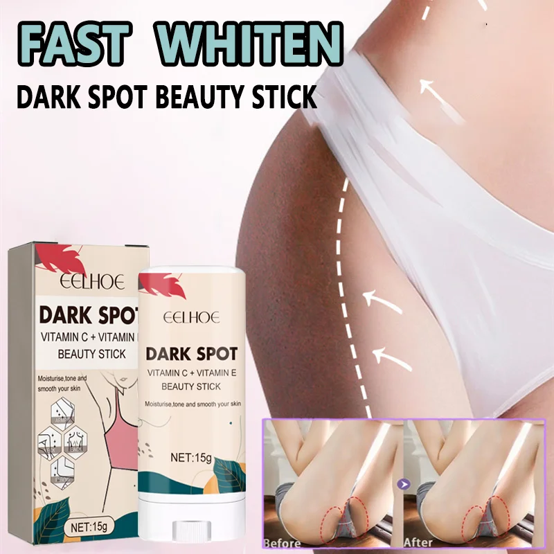 Dark Spot Beauty Stick Dark Knuckles Fast Brighten Elbows Hand Knuckle Brightening Knee Black Skin Spot Lighten Stains Remover
Dark Spot Beauty Stick Dark Knuckles Fast Brighten Elbows Hand Knuckle Brightening Knee Black Skin Spot Lighten Stains Remover