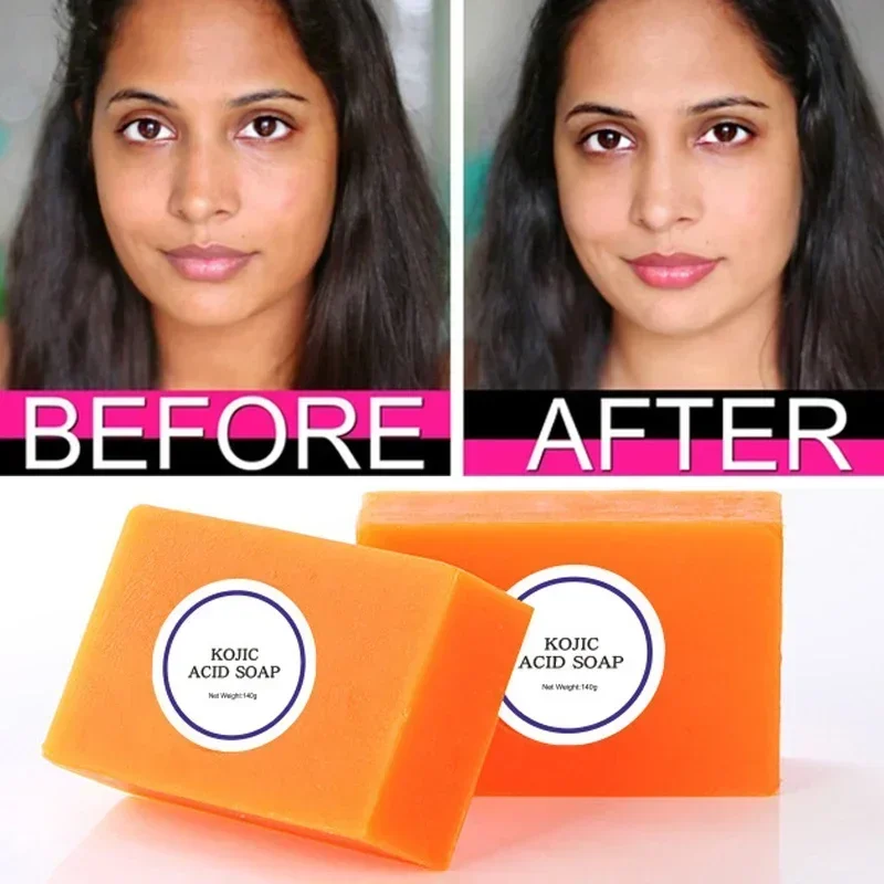 Heallor 100g White Kojic Acid Soap Hand Made Soap Skin Bleaching Soaps Brightening Face Option Glutathione Soaps Skin Lightening
Heallor 100g White Kojic Acid Soap Hand Made Soap Skin Bleaching Soaps Brightening Face Option Glutathione Soaps Skin Lightening