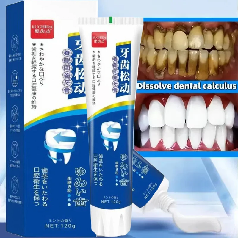 Dental Calculus Remover Bad Breath Removal Whitening Teeth Toothpaste Brightening Preventing Periodontitis Dental Cleansing Care
Dental Calculus Remover Bad Breath Removal Whitening Teeth Toothpaste Brightening Preventing Periodontitis Dental Cleansing Care